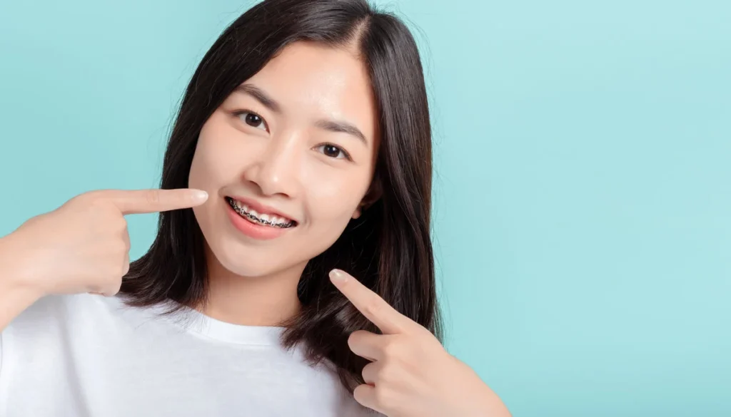 Dental braces of young asian woman wearing braces with white teeth concept.